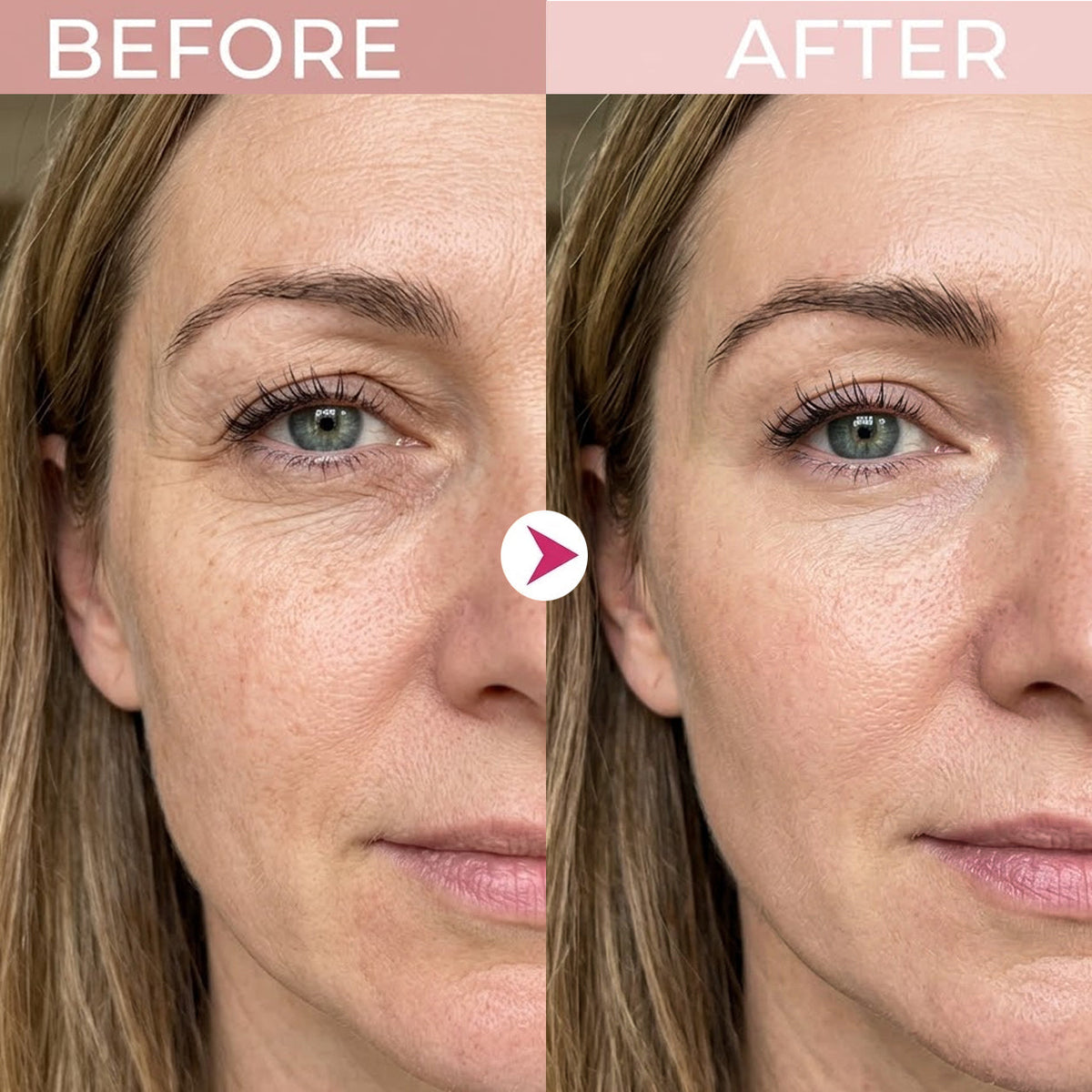 🔥Final 2 Hour 80% OFF🔥 AQA P7 Eye Renewal Crème