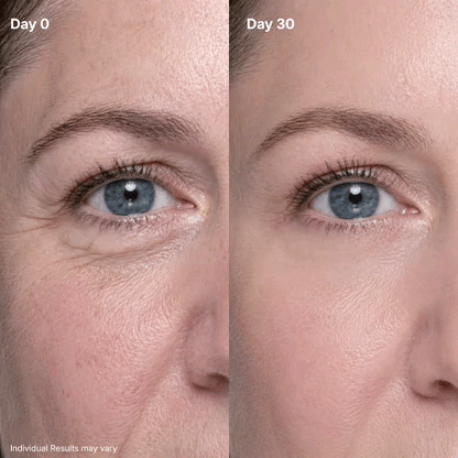 🔥Final 2 Hour 80% OFF🔥 AQA P7 Eye Renewal Crème